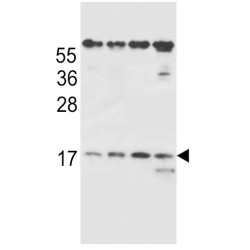 T-Cell Receptor Beta Chain V Region CTL-L17 / TCRB (TRBV7-9) Antibody