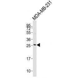 T-Cell Receptor Beta Chain V Region CTL-L17 / TCRB (TRBV7-9) Antibody