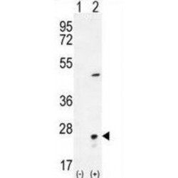 Visinin-Like Protein 1 (VSNL1) Antibody