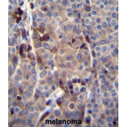 PRAME Family Member 8 (PRAMEF8) Antibody