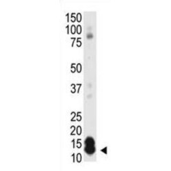 Small Ubiquitin Related Modifier Protein 1 (SUMO1) Antibody