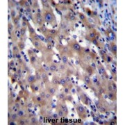 X-Linked Retinitis Pigmentosa GTPase Regulator (RPGR) Antibody