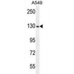 X-Linked Retinitis Pigmentosa GTPase Regulator (RPGR) Antibody