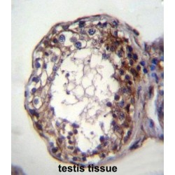 Sphingomyelin Phosphodiesterase (SMPD1) Antibody