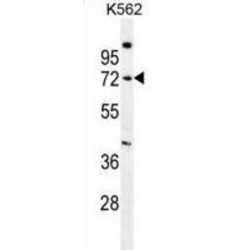 Sphingomyelin Phosphodiesterase (SMPD1) Antibody