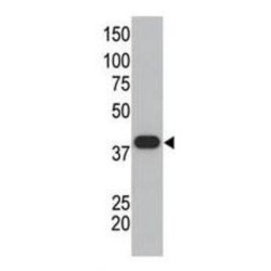 Small Ubiquitin Related Modifier Protein 1 (SUMO1) Antibody