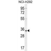 Pulmonary Surfactant-Associated Protein A2 (SFTPA2) Antibody