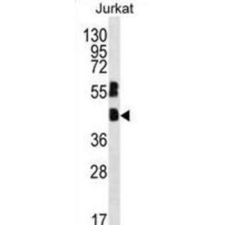 Transcription Factor MafB (MAFB) Antibody