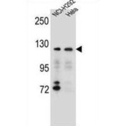 Sorting Nexin 13 (SNX13) Antibody