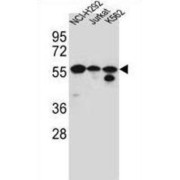 Forkhead Box Protein N2 (FOXN2) Antibody