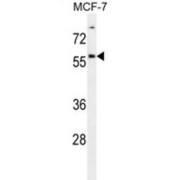 Zinc Finger Protein 165 (ZNF165) Antibody