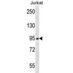 Serine Protease 7 (PRSS7) Antibody