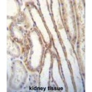 Myosin-IIIb (MYO3B) Antibody