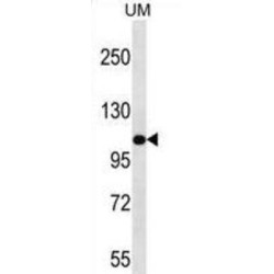 Myosin-IIIb (MYO3B) Antibody