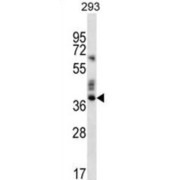 Olfactory Receptor 9K2 (OR9K2) Antibody