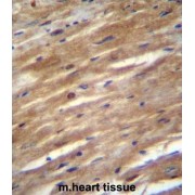 Fibronectin Type III And SPRY Domain Containing 2 (FSD2) Antibody