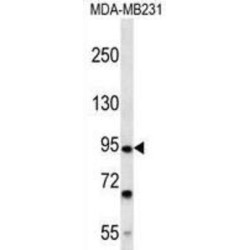 Fibronectin Type III And SPRY Domain Containing 2 (FSD2) Antibody