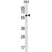 Deleted In Azoospermia Protein 2 (DAZ2) Antibody