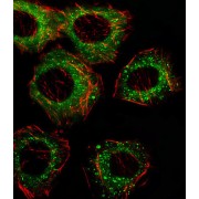 Fatty Acid Desaturase 2 (FADS2) Antibody