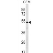 Potassium Voltage-Gated Channel Subfamily J Member 4 (KCNJ4) Antibody