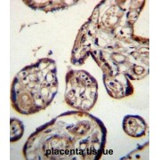 Calumenin (CALU) Antibody