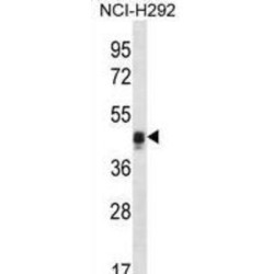 Calumenin (CALU) Antibody