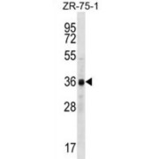 Cyclin-Y-Like Protein 2 (CCNYL2) Antibody