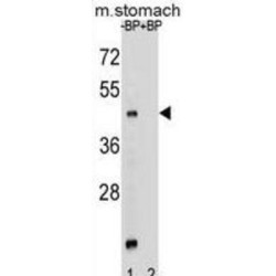 Ghrelin O-Acyltransferase (MBOAT4) Antibody