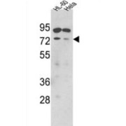 SUMO1/Sentrin Specific Peptidase 1 (SENP1) Antibody