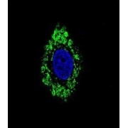 Segment Polarity Protein Dishevelled Homolog DVL-1 (DVL1) Antibody