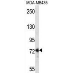 Segment Polarity Protein Dishevelled Homolog DVL-1 (DVL1) Antibody