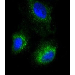 Pulmonary Surfactant-Associated Protein C (SFTPC) Antibody