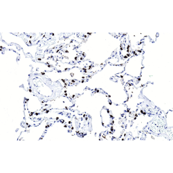 Pulmonary Surfactant-Associated Protein C (SFTPC) Antibody