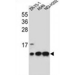Cytochrome C Oxidase Subunit 6B1 (COX6B1) Antibody