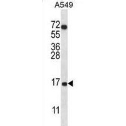 Cytochrome C Oxidase Subunit 7A2 Like (COX7A2L) Antibody