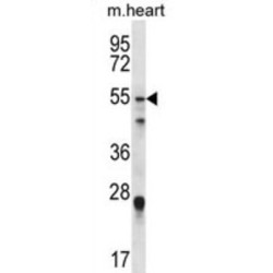 Forkhead Box Protein O6 (FOXO6) Antibody