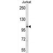 WB analysis of Jurkat cells.