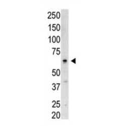 SUMO1/Sentrin/SMT3 Specific Peptidase 3 (SENP3) Antibody