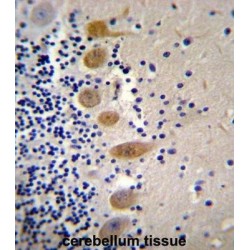 Macrophage Stimulating Protein/Hepatocyte Growth Factor Like (MST1) Antibody