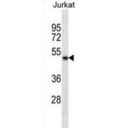 Putative Neuroblastoma Breakpoint Family Member 5 (NBPF5) Antibody