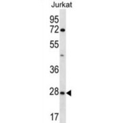 Olfactory Receptor Family 6 Subfamily T Member 1 (OR6T1) Antibody