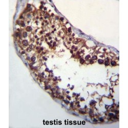 Protein O-Mannosyl-Transferase 1 (POMT1) Antibody