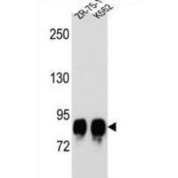 Protein O-Mannosyl-Transferase 1 (POMT1) Antibody