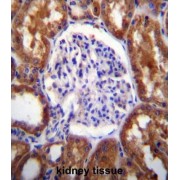 Solute Carrier Family 12 Member 6 (SLC12A6) Antibody