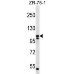 Solute Carrier Family 12 Member 6 (SLC12A6) Antibody