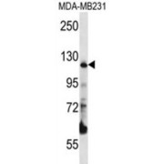 Presequence Protease, Mitochondrial (PITRM1) Antibody