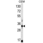 Free Fatty Acid Receptor 1 (FFAR1) Antibody