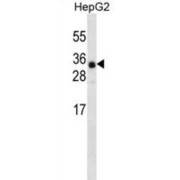 Ankyrin Repeat Domain-Containing Protein 46 (ANR46) Antibody