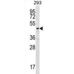 Tubulin-Specific Chaperone Cofactor E-Like Protein (TBCEL) Antibody