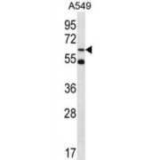 Zinc Finger Protein 248 (ZNF248) Antibody